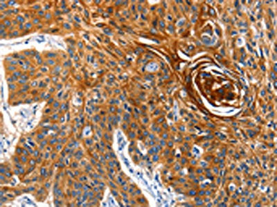 AQP5 Antibody