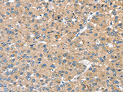 STK32C Antibody