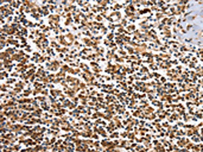 IRAK3 Antibody
