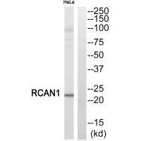 RCAN1 Antibody