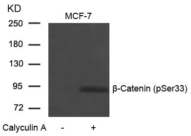 Phospho-CTNNB1 (Ser33) Antibody