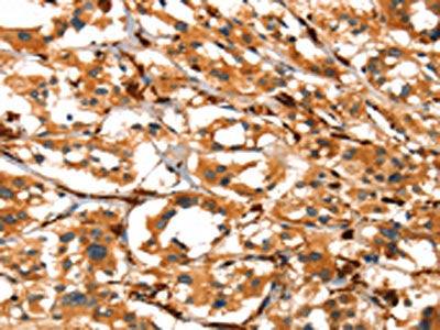 ACTA2 Antibody