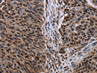 KDM3B Antibody