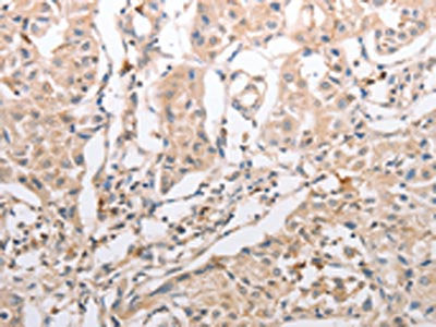INA Antibody