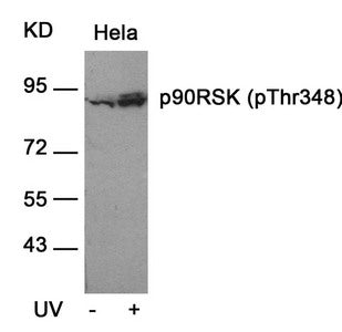 Phospho-RPS6KA1 (Thr348) Antibody