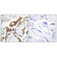 PHLDA2 Antibody