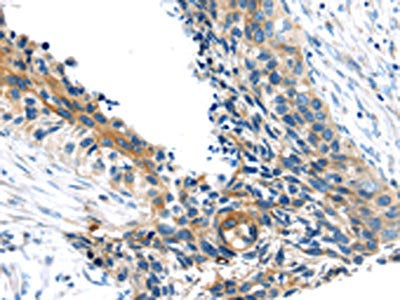 TSC2 Antibody