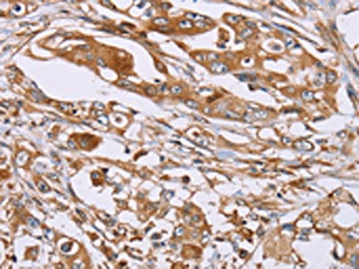 OS9 Antibody