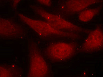Phospho-ABL1 (Tyr412) Antibody