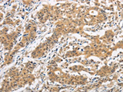 ITGB3BP Antibody