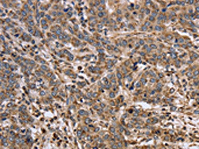 EPOR Antibody