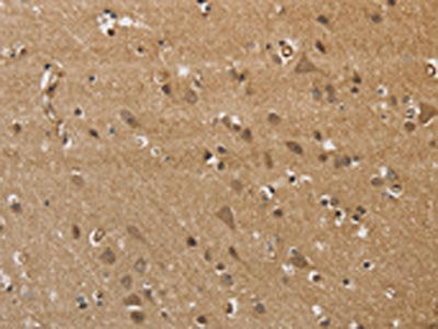 KCNN4 Antibody