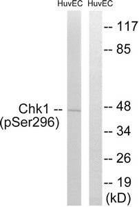 Phospho-CHEK1 (Ser296) Antibody