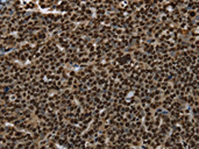 ANP32E Antibody