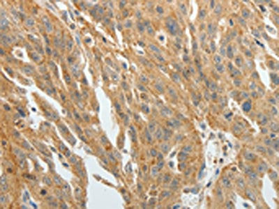 F3 Antibody