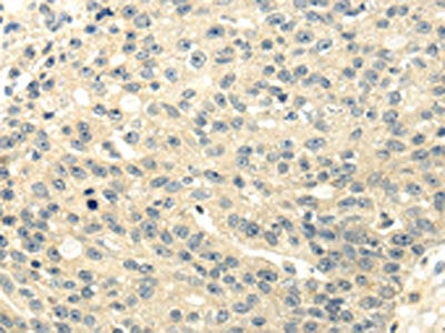 GAD1 Antibody