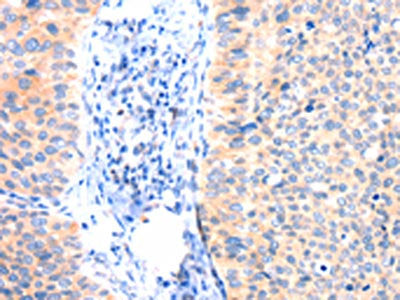 ANK3 Antibody