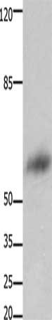 FOXJ3 Antibody