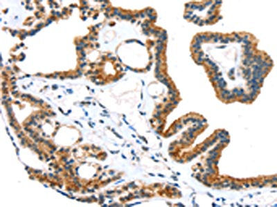 TRPM6 Antibody