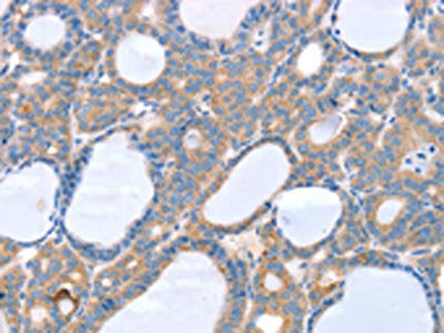 SLC25A13 Antibody