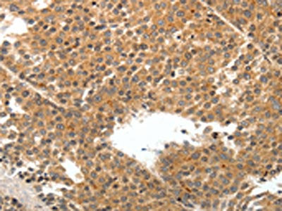 TEK Antibody