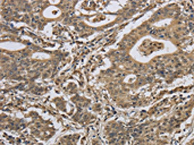 IPO7 Antibody