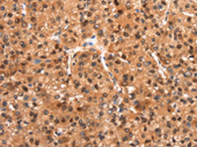 FOXN2 Antibody