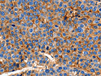 CLDN1 Antibody