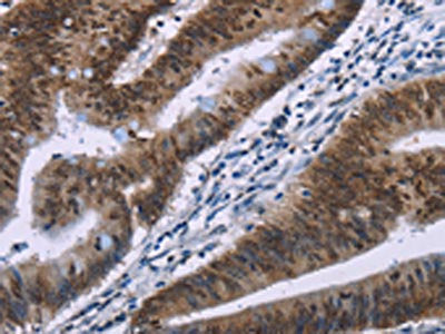 HMGA1 Antibody