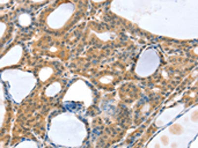 SNX3 Antibody