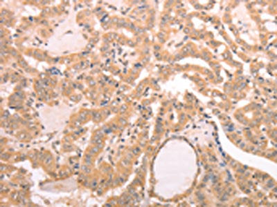 AASDHPPT Antibody