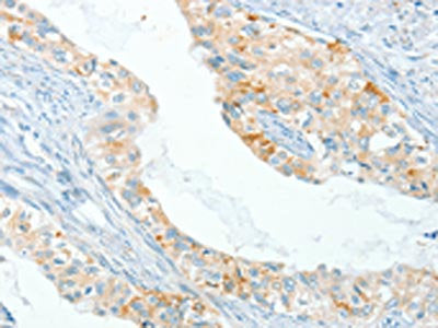 APOL2 Antibody