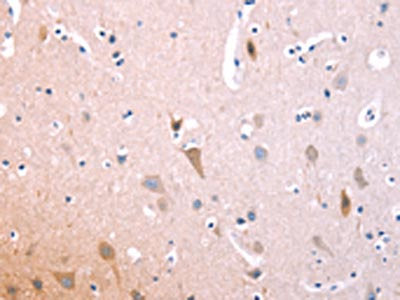 IL1RL1 Antibody