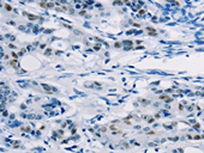 ABCC1 Antibody