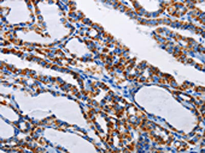 NFKBIA Antibody