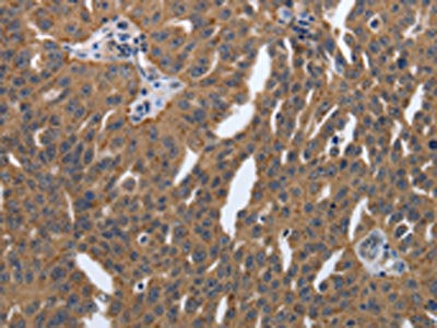 PDGFA Antibody
