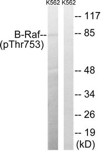 Phospho-BRAF (Thr753) Antibody