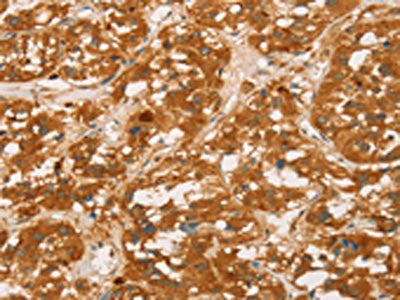 SPN Antibody
