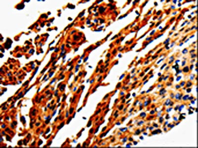 ADD1 Antibody
