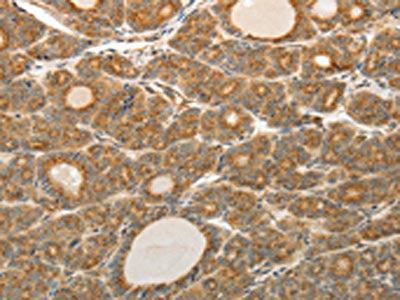 AKR1C1 Antibody