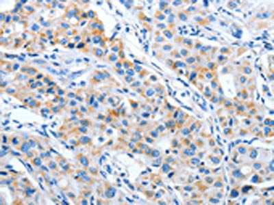 IMMT Antibody
