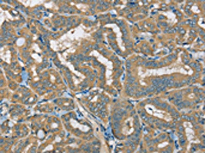 ATP2A3 Antibody