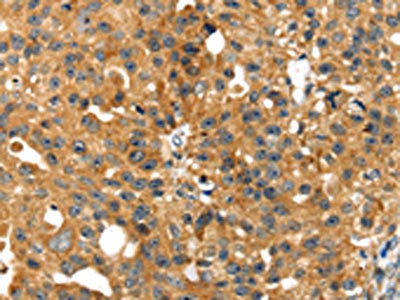 SMYD4 Antibody