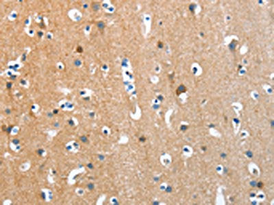 ANKMY1 Antibody