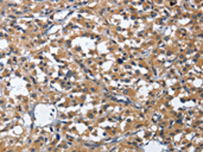CDK5RAP3 Antibody