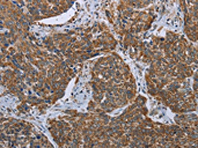 MDFIC Antibody