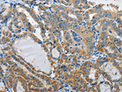 GZMB Antibody