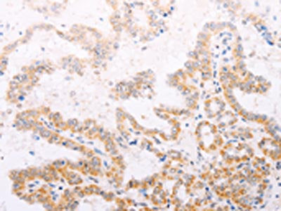 TYR Antibody