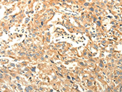 AGRN Antibody