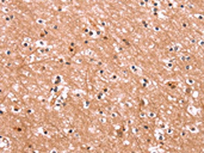 ENPP4 Antibody